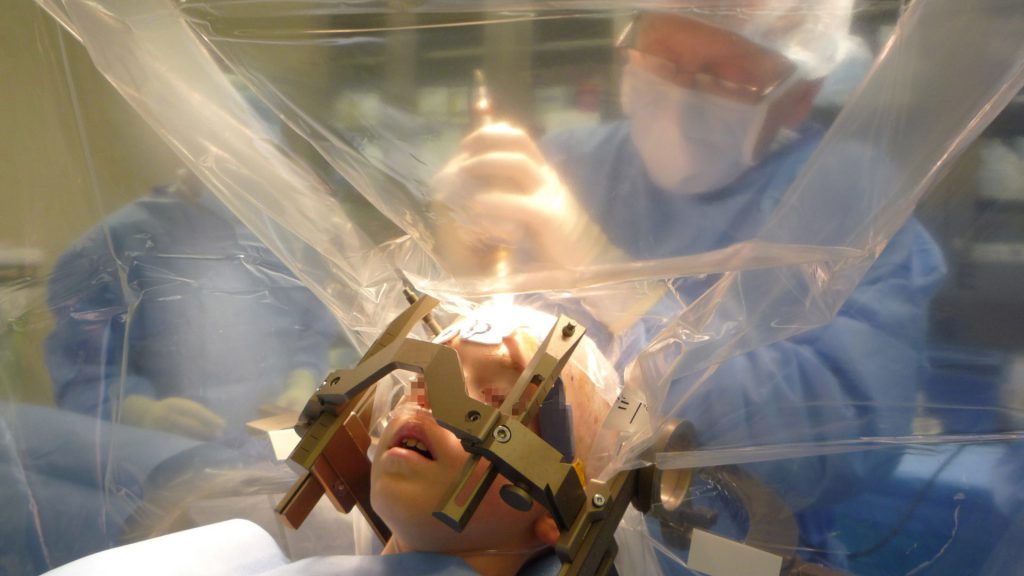 Anestesia come agiscono i farmaci che &quot;spengono&quot; il cervello