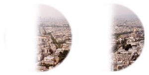 Parigi vista con emianopsia omonima sinistra